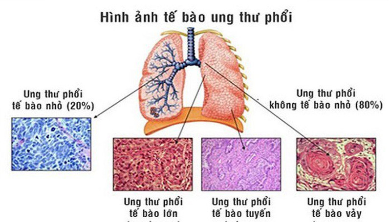 trang cá độ bóng đá